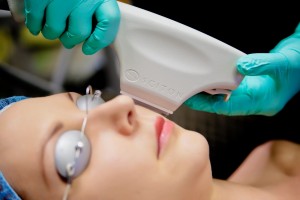 Austin IPL BBL Photofacial 4