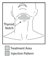 Kybella-treatment-Austin