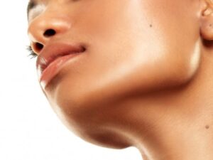Botox Face Lift: Nefertiti Lift