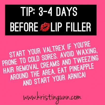 WHAT TO DO BEFORE LIP FILLER